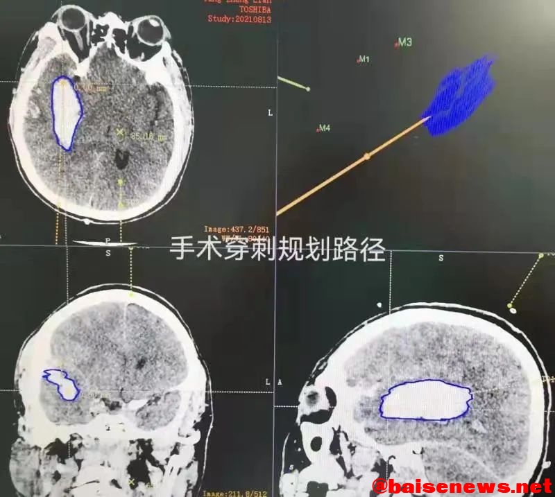 名医风采 | 李忠华: 一名医学博士对百色红土地的情怀 名医,医风,风采,李忠,李忠华