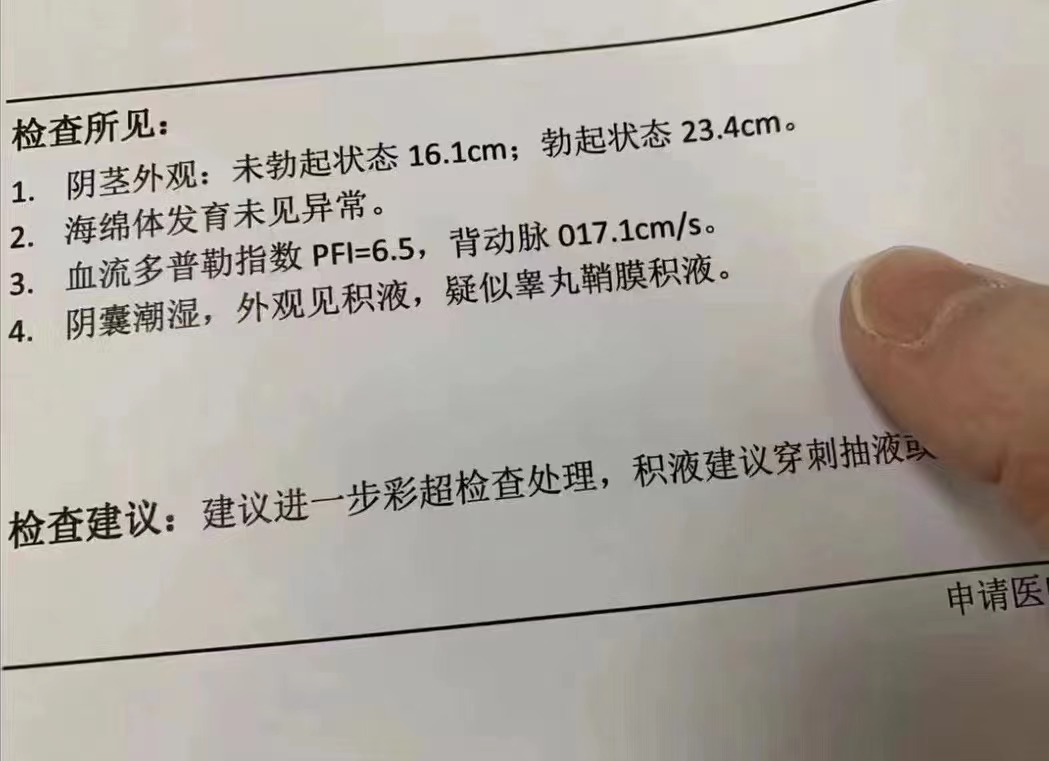 有点心烦现在！ 有点,点心,心烦,现在