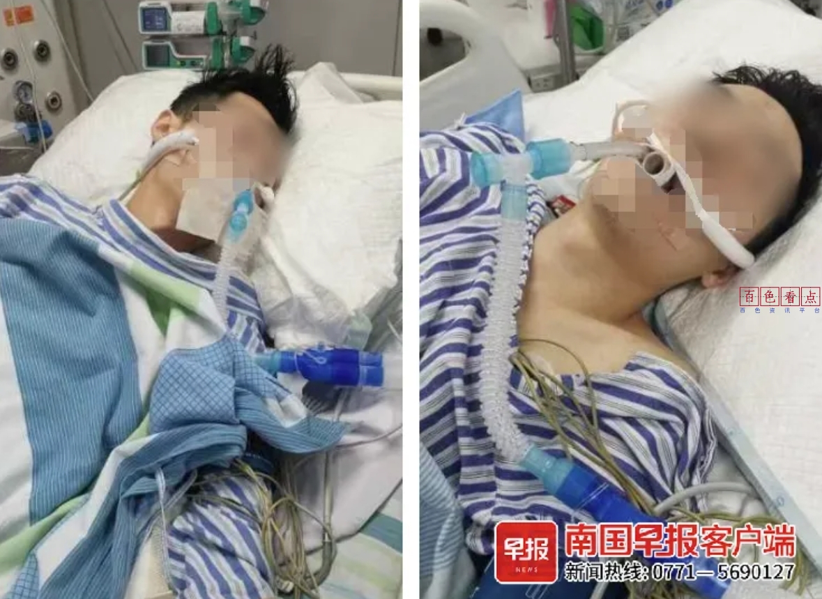 为治腋臭！美容院一针下去，百色19岁双胞胎被送进ICU抢救20多天...... 双胞胎,ICU,8月,14日,19岁